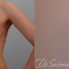 Подтяжка груди у доктора Свиридова — чудеса хирургии на svsviridov.ru